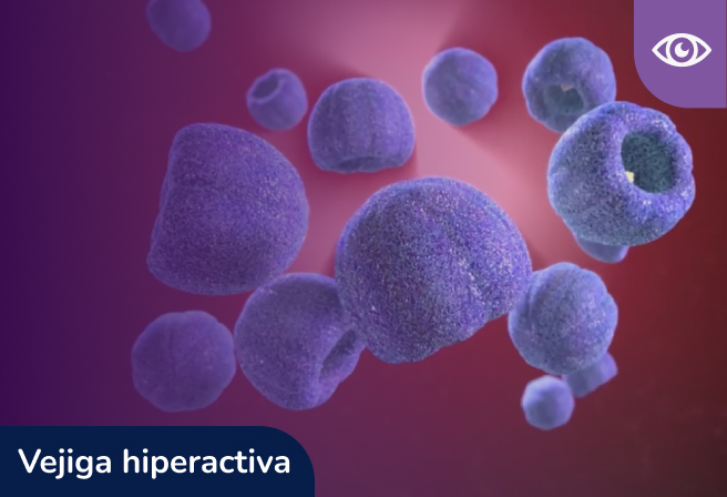 Mecanismo de acción de botox en el síndrome de vejiga hiperactiva